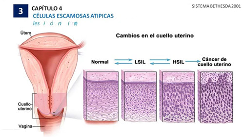 Procesa